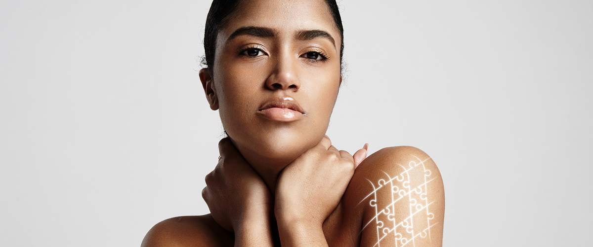 Let’s Talk Lymph: Why Drainage Suppositories Are the Secret to Feeling Lighter (and Looking Less Puffy)