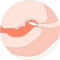 PUSH IT GENTLY INSIDE